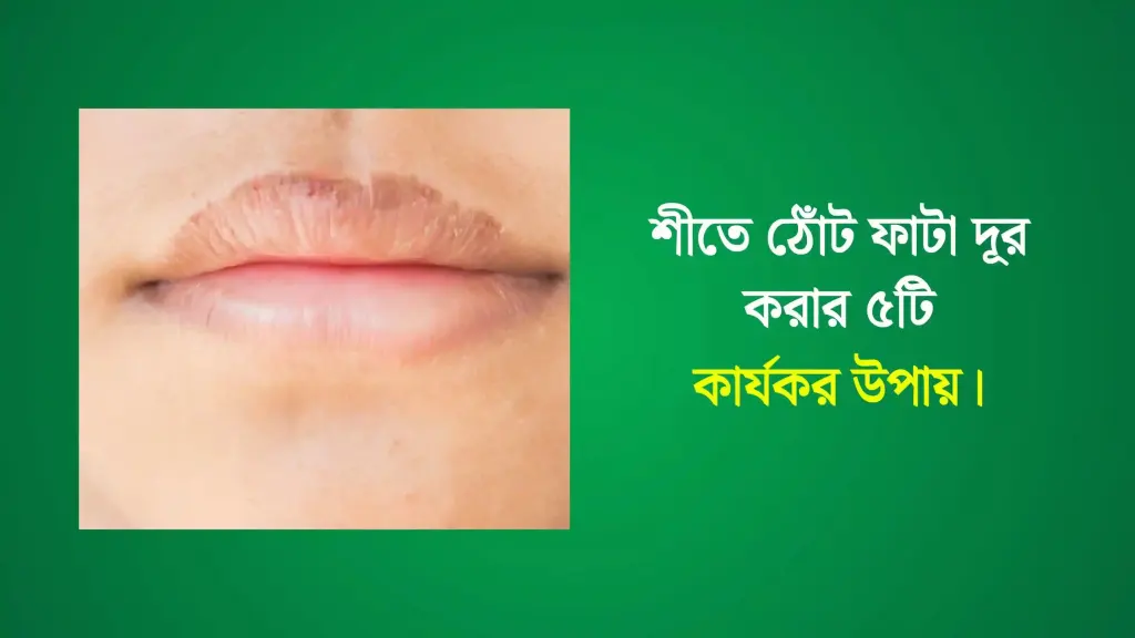 শীতে ঠোঁট ফাটা দূর করার ৫টি কার্যকর উপায় জেনে নিন