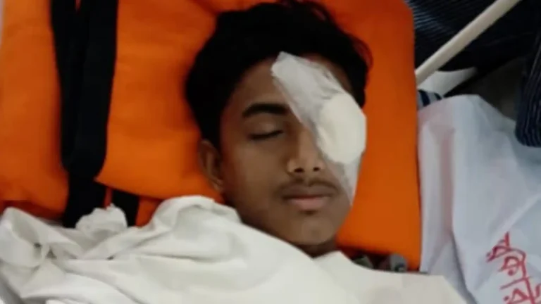 হবিগঞ্জের আলিফের চোখে চিরতরে অন্ধত্বের আশঙ্কা, সামাজিক মাধ্যমে ক্ষোভ ও নিন্দার ঝড়