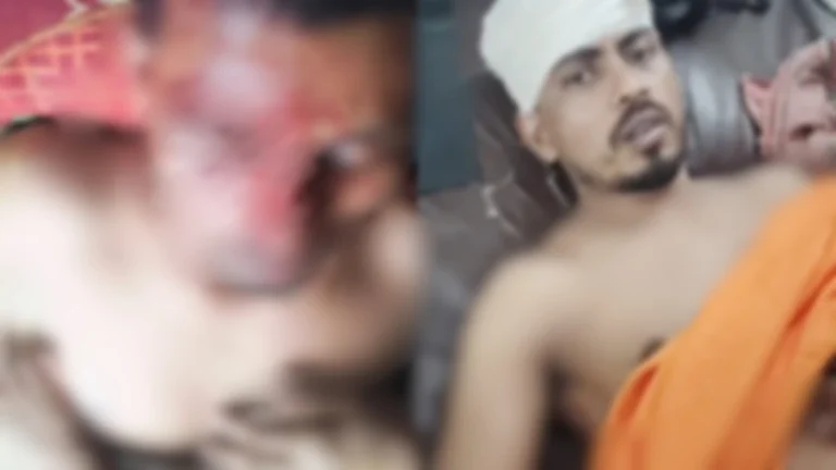 দোয়ারাবাজারে জমির সীমানা নির্ধারনকে কেন্দ্র করে চাচা-ভাতিজার সংঘর্ষ   ‎